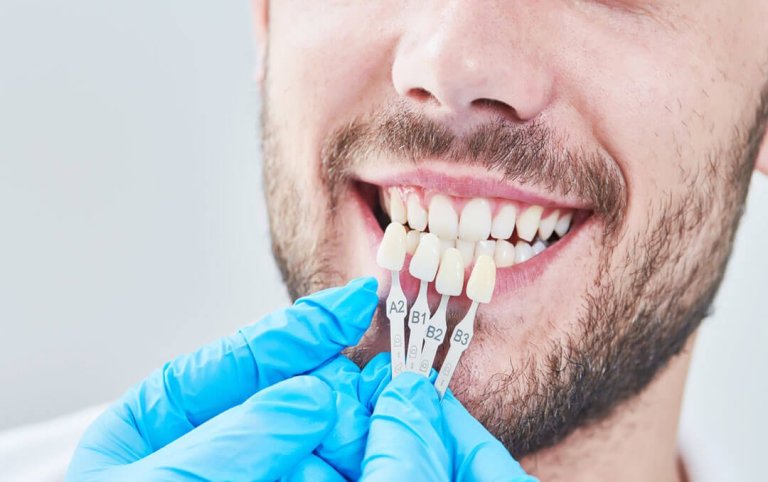 The Benefits of Cosmetic Dentistry: Enhancing Your Smile and Confidence